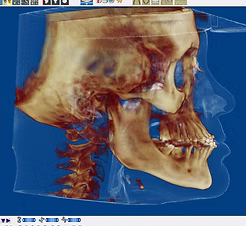 fc3311_c1a9f6cc9a3f4fa0aa30121834edc162~mv2_d_1893_1742_s_2.avif